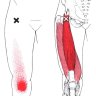 Acupuncture & RMT massage treatment for leg & knee pain $76/h